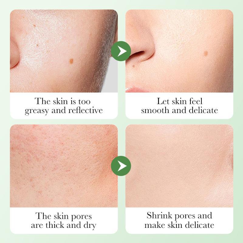 BIOAQUA Cantele Asiatica Skincare Repair Set